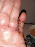 finger.jpg finger.jpg